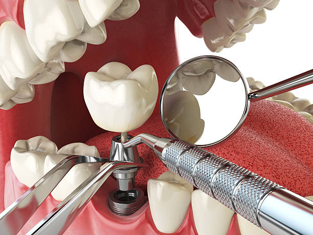 Reliable AR Emergency Dental Service Solutions